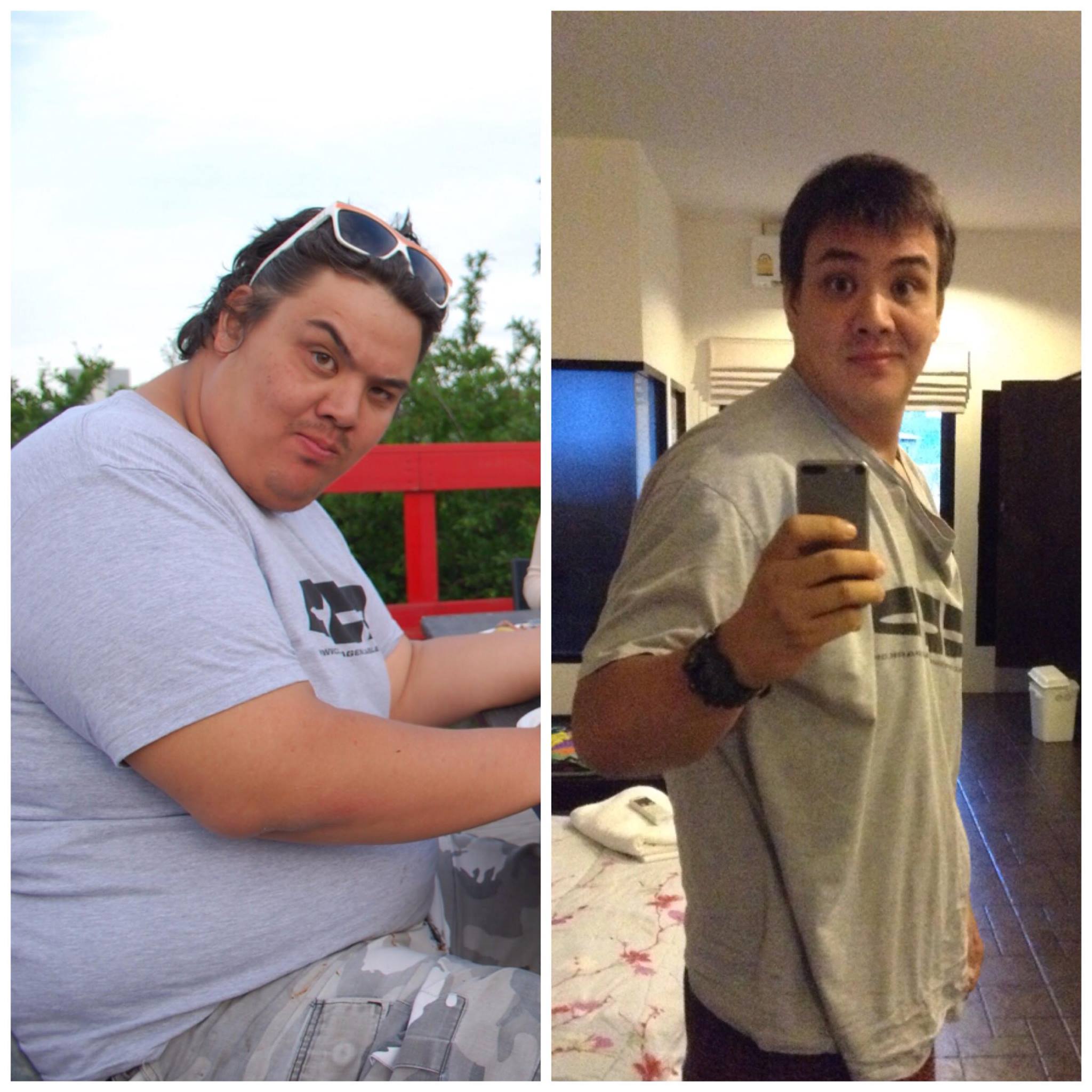 Before - After Weight Loss